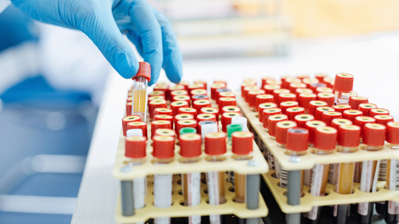 MLT (ASCP) Medical Laboratory Technician Study Guide & Exam Prep