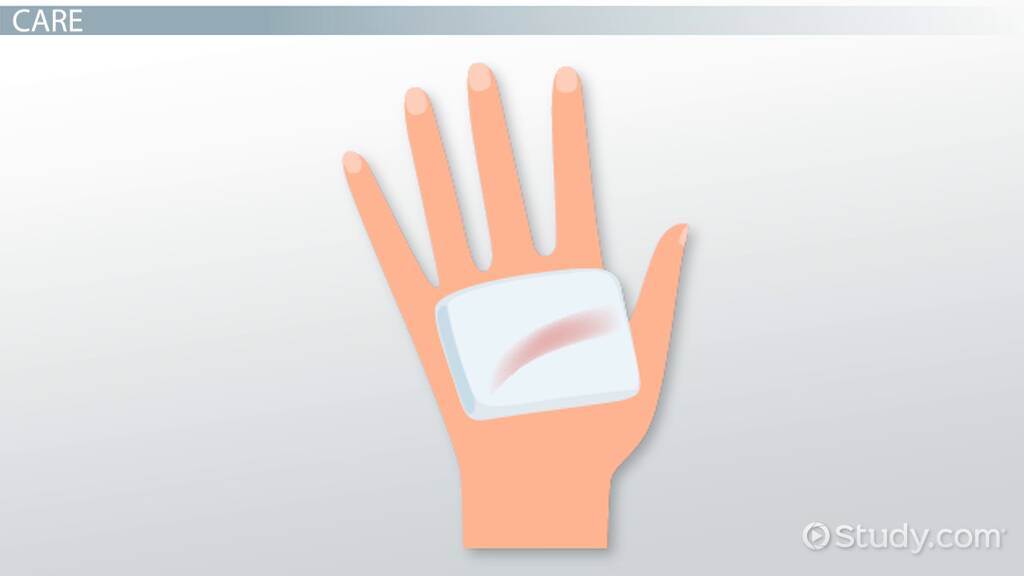 Granulating Wound Stages Definition & Types Video & Lesson