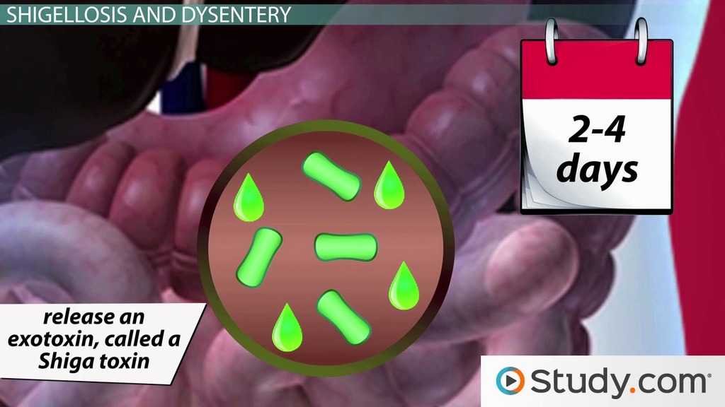 Dysentery and the Bacteria Shigella Symptoms & Causes Video & Lesson