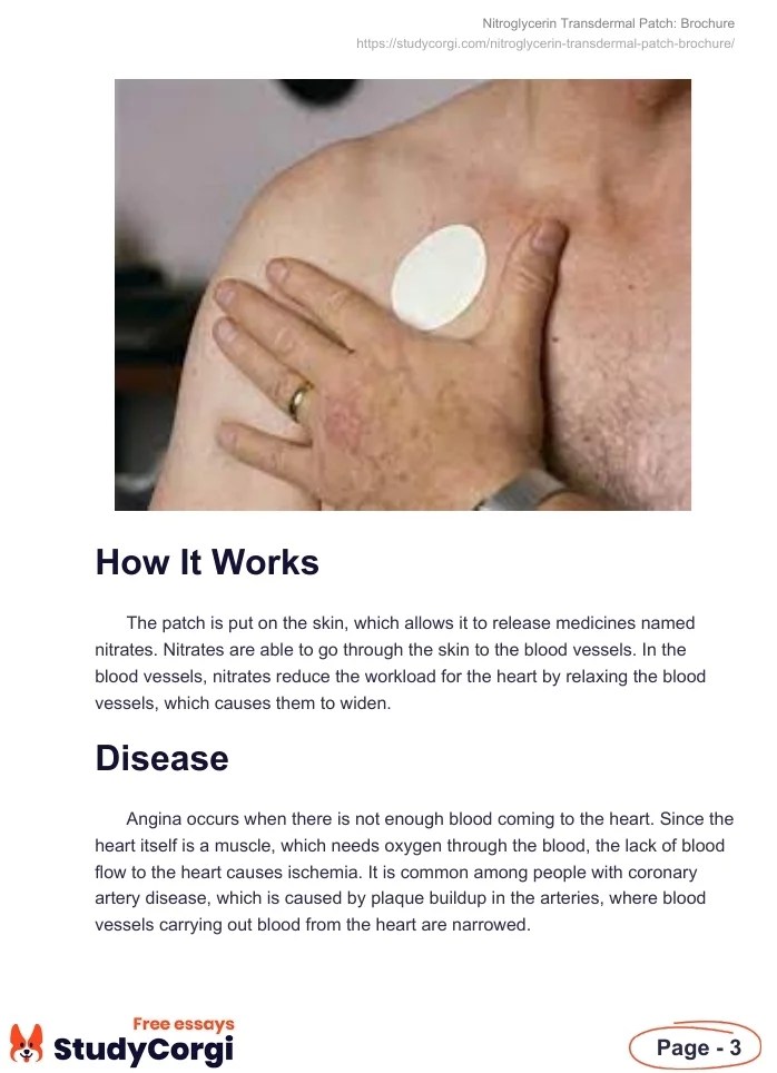 Nitroglycerin Transdermal Patch Brochure Free Essay Example