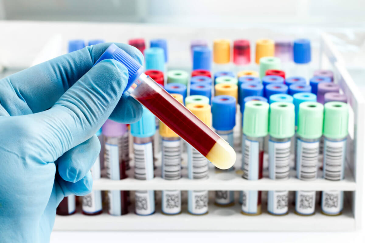Why The Latest ‘Biological Age’ Tests May Not Be All They’re Cracked Up To Be Why The Latest ‘Biological Age’ Tests May Not Be All They’re Cracked Up To Be