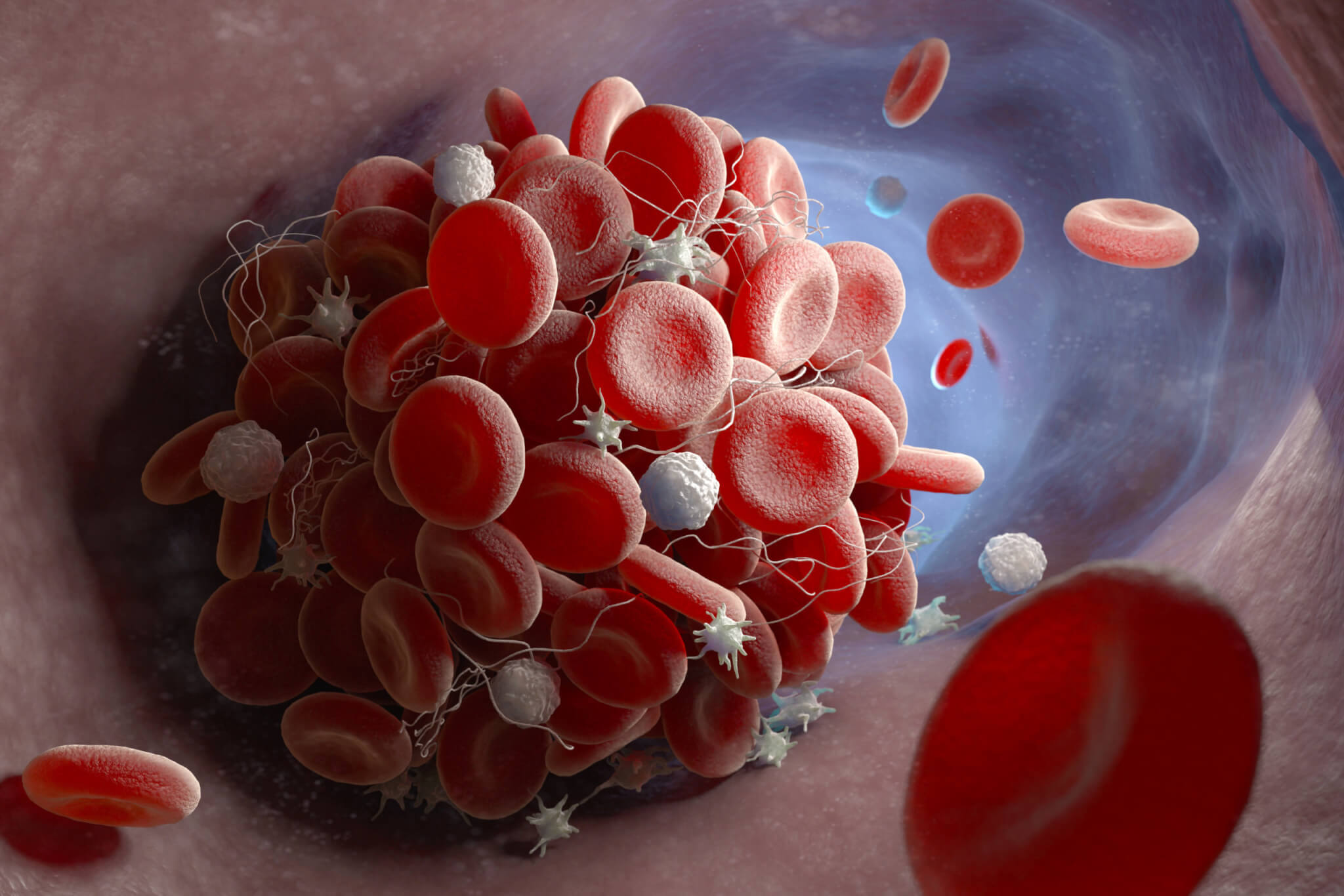 New blood thinner can prevent blood clots without risk of excessive