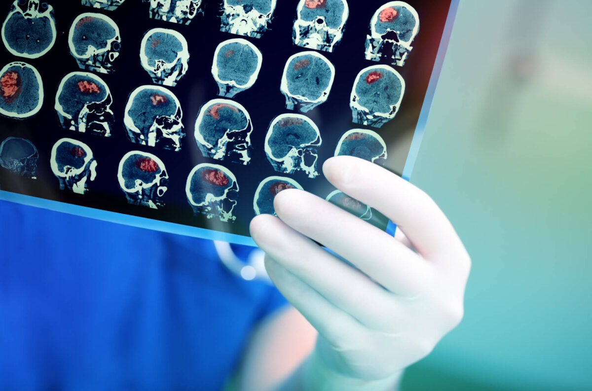 Scientists Found The Brain’s ‘Heartbeat’ — And It May Explain Why Some Age Faster