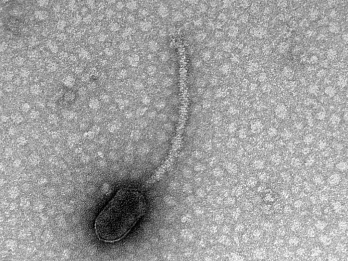 Sick sense Scientists warn viruses may have 'eyes and ears' on humans