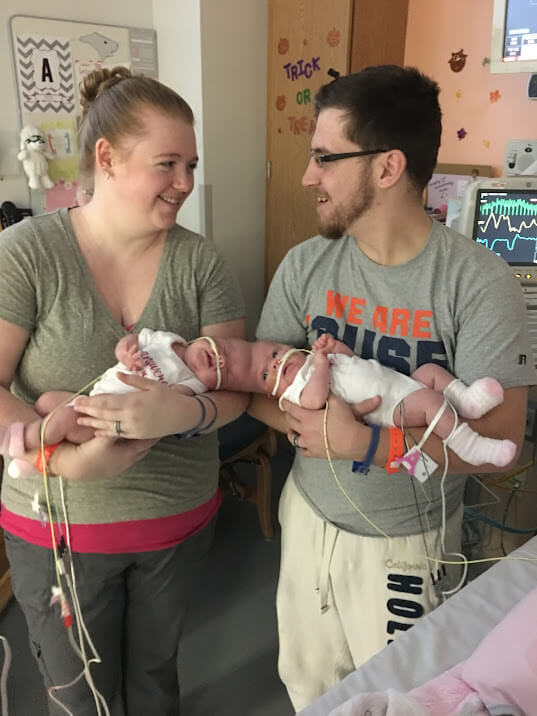 6 years later, rare conjoined twins who survived separation surgery