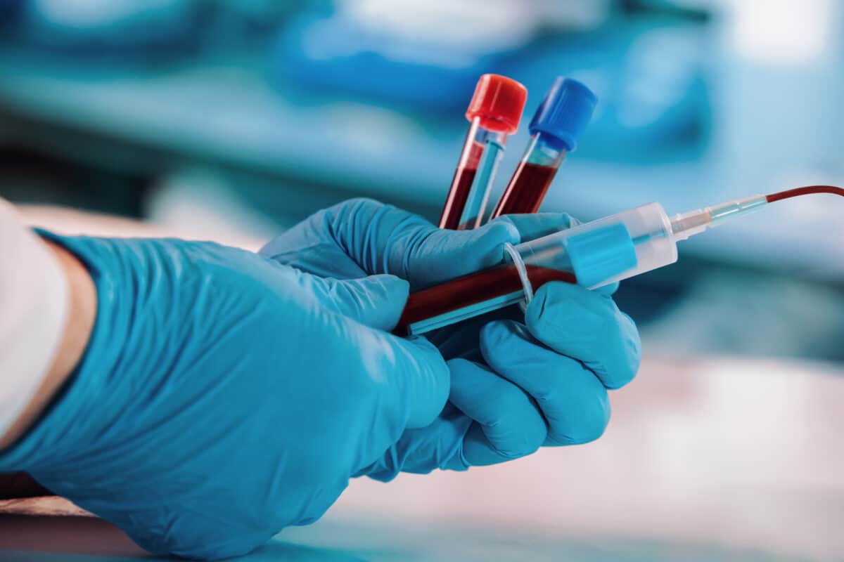 New Blood Test Tells Which Of Your Organs Are Aging Fastest, And How Long You Might Live New Blood Test Tells Which Of Your Organs Are Aging Fastest, And How Long You Might Live