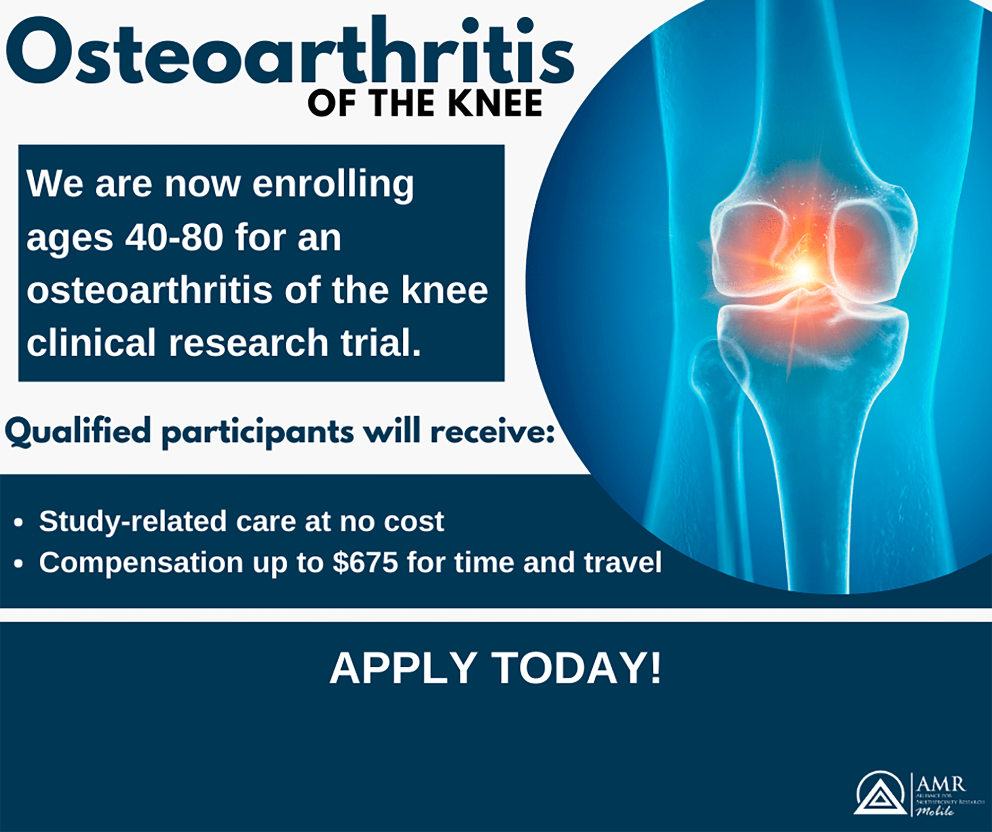 StudyKIK OSTEOARTHRITIS KNEE STUDY
