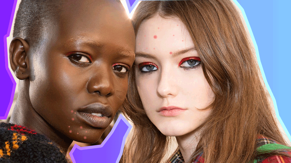 How to Cover Up Breakouts With Makeup, Minus the Cakey Finish
