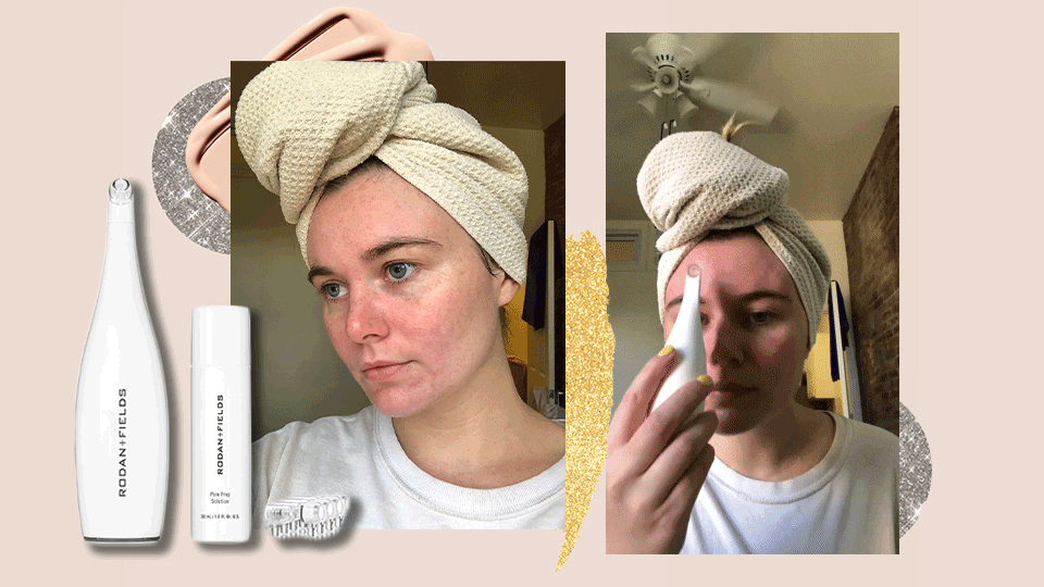 Rodan + Fields Pore Cleansing MD Review for BlackheadProne Skin
