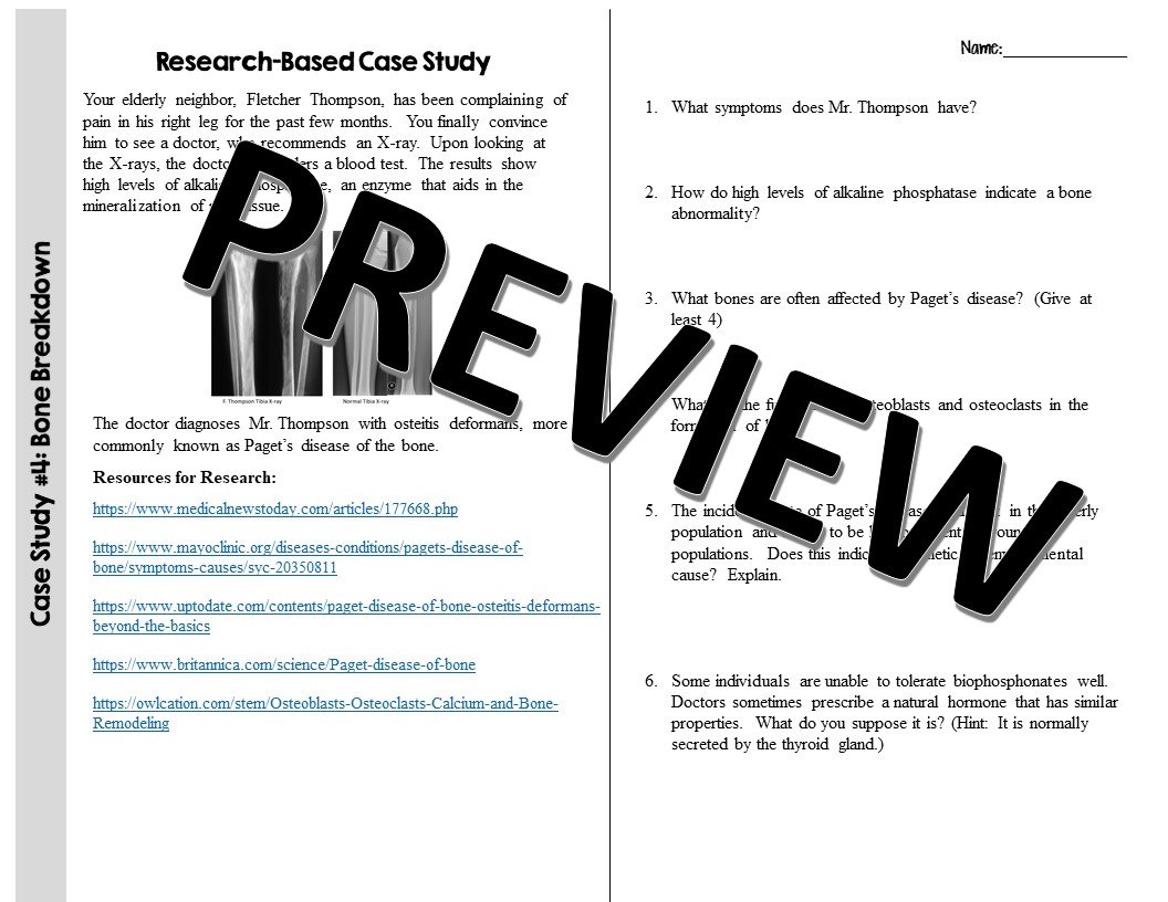 Anatomy Case Studies Paget's Disease Suburban Science