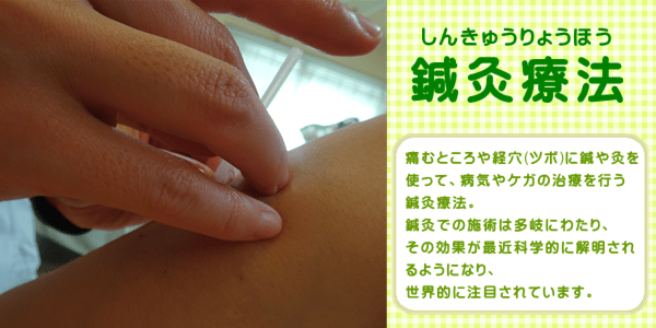 はり・灸 【公式】すがわら鍼灸接骨院
