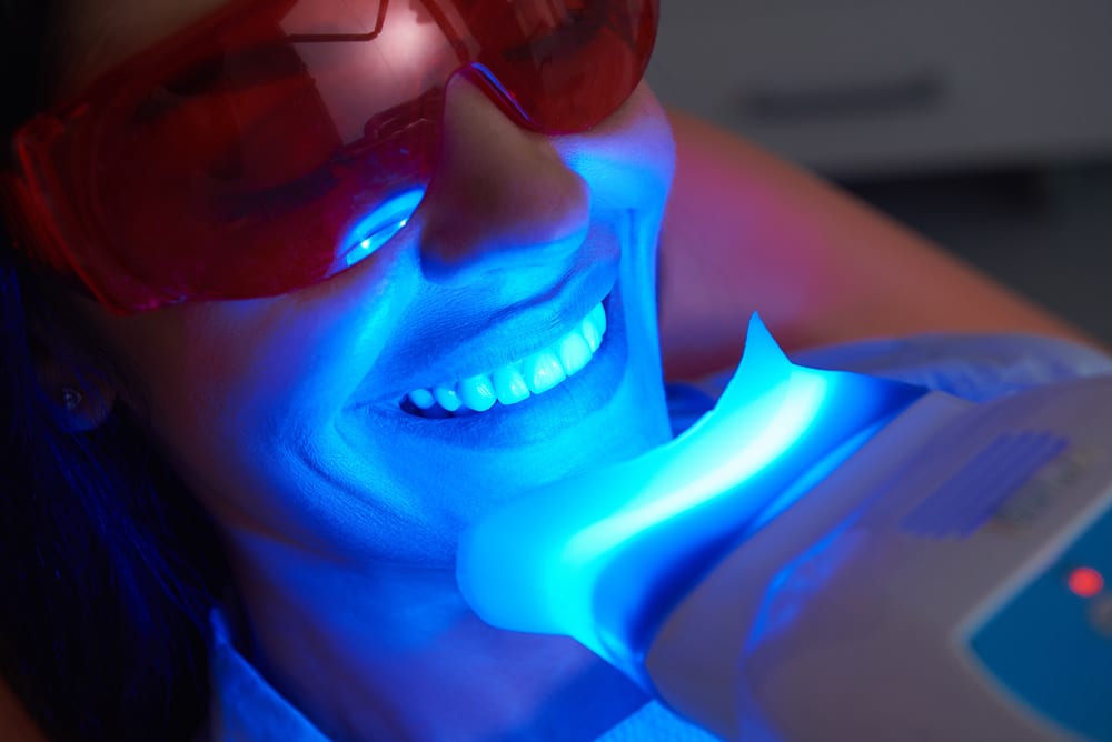 Why Professional Teeth Whitening? Summit Family & Cosmetic Dentistry