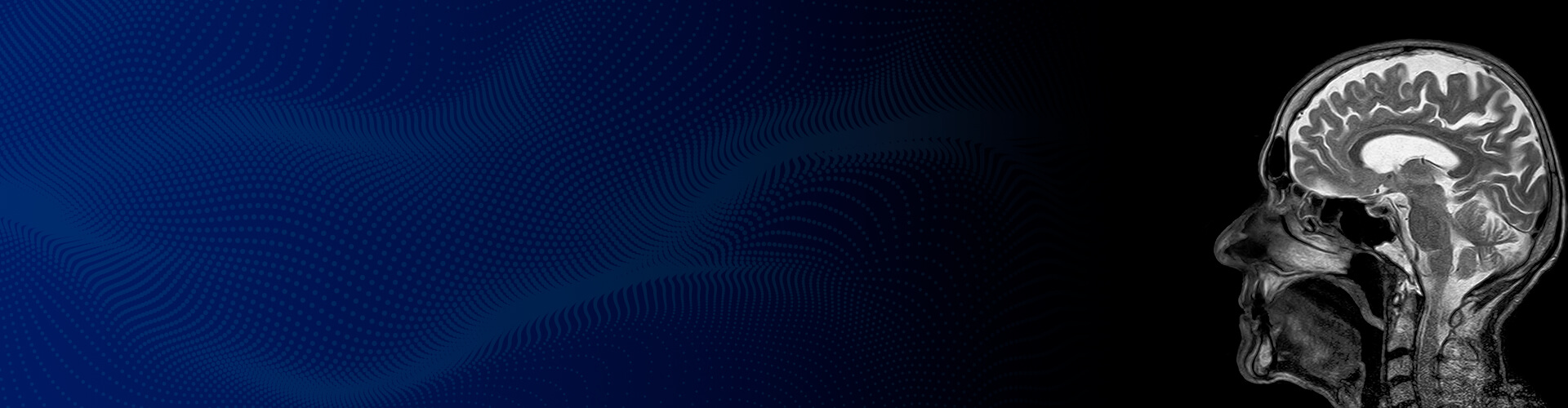 Summit Radiology Diagnostic & Interventional Imaging Services