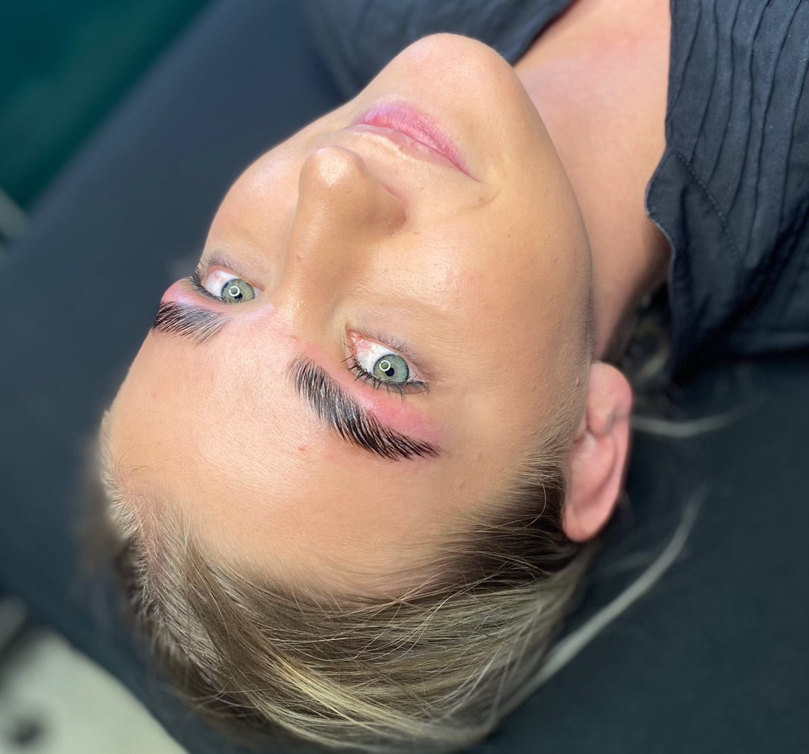 TED™ Hair Restoration in Utah Non Surgical Hair Loss Treatment