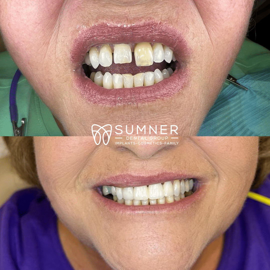 Dentist Gallatin TN Sumner Dental Group