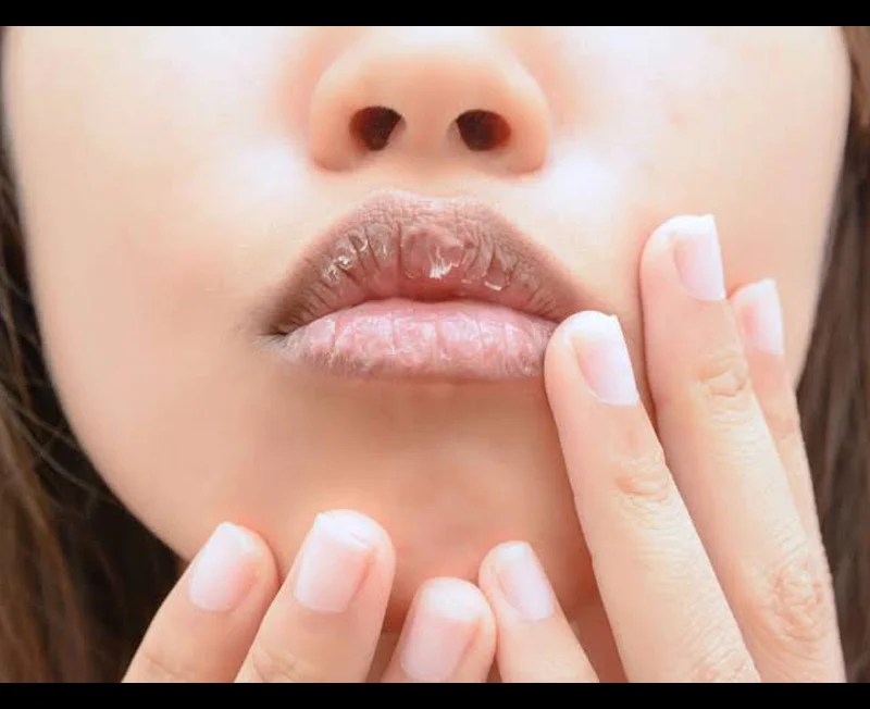Get Rid of Chapped Lips With This Easy DIY Lip Mask Sunday