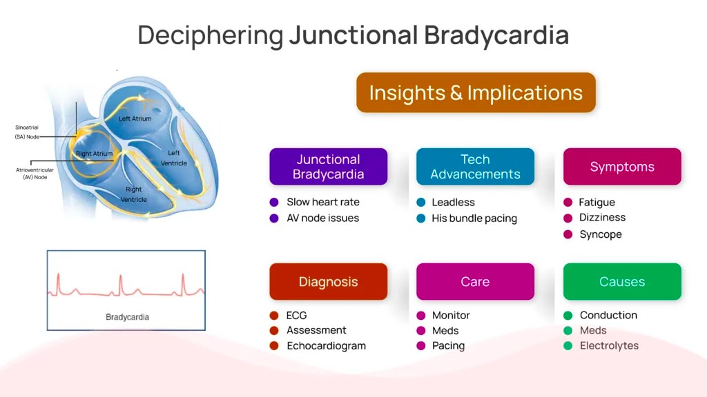 Junctional Bradycardia Meaning, Causes and Symptoms