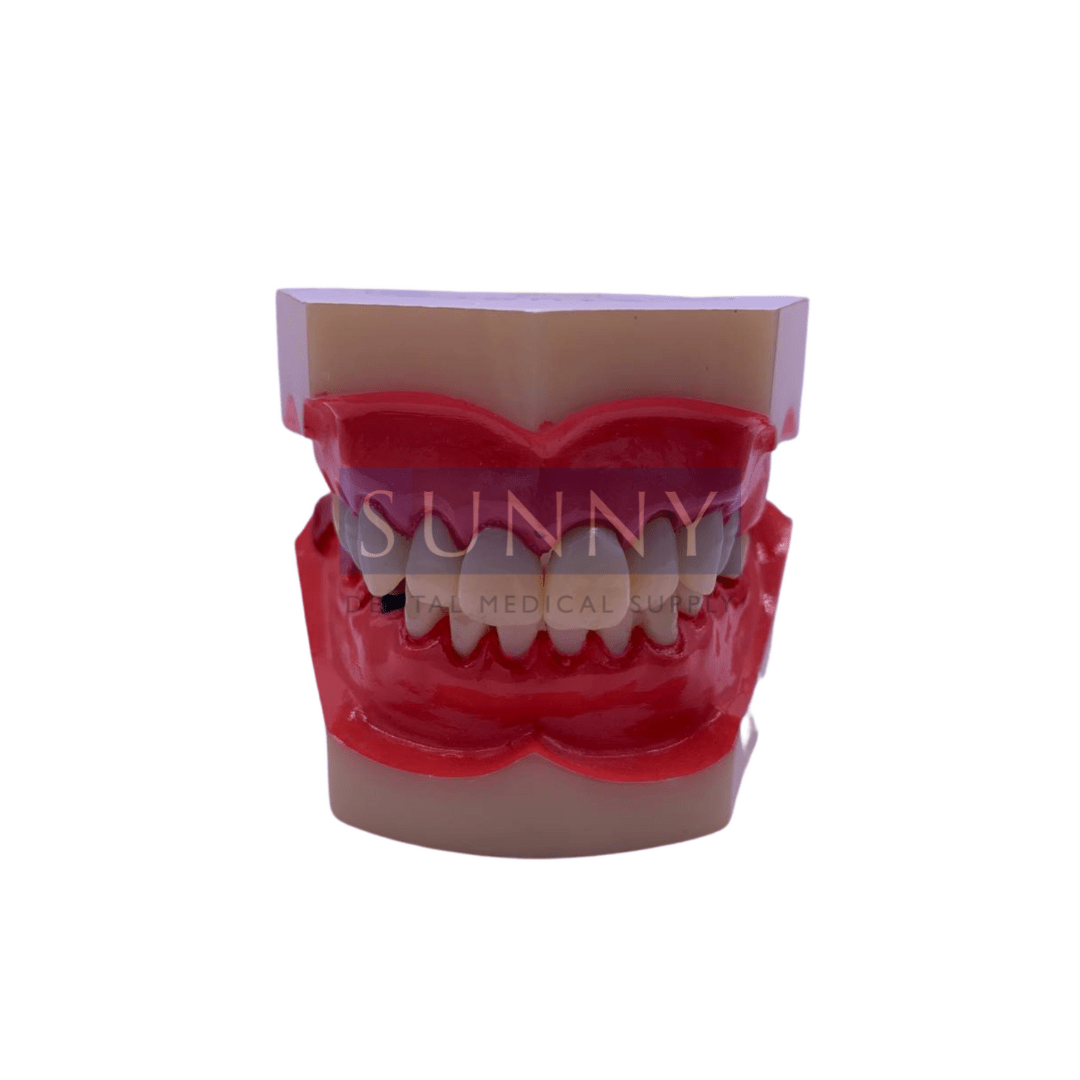 Tooth Study Model Sunny Dental Medical Supply