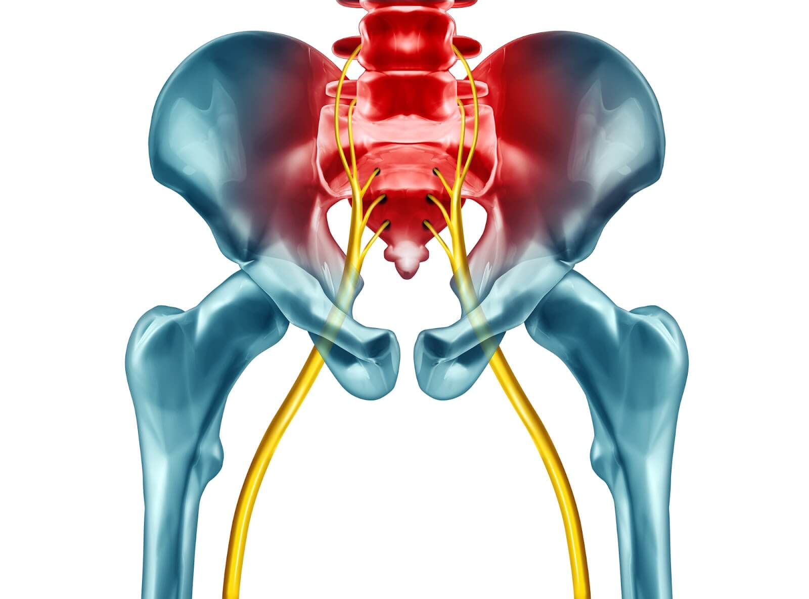 What Is Sciatica Surgery And How Does It Work?