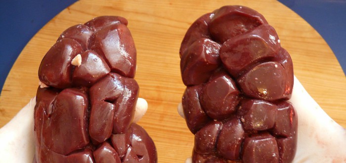 Partes del cuerpo no necesarias para seguir viviendo