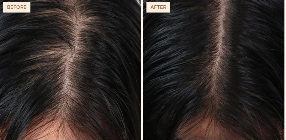 vegamour hair growth serum