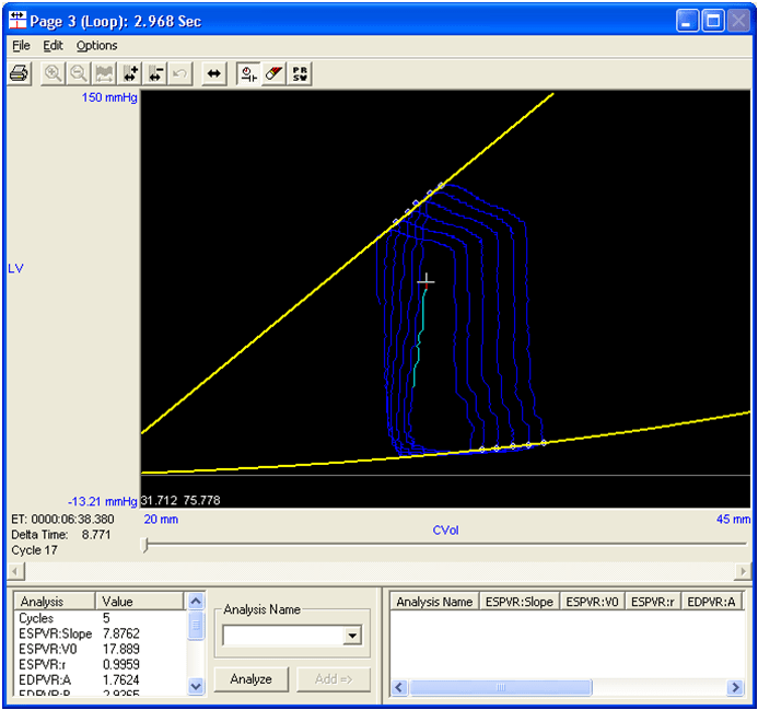 Pressure-Volume (PV) Loop Analysis Process – Data Sciences International