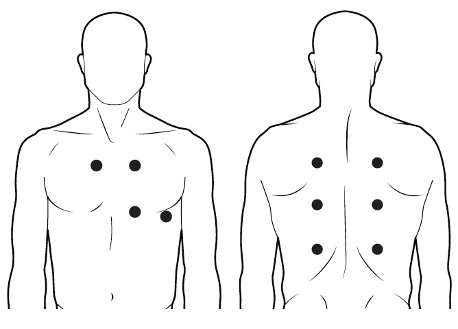 CORE 500™ placement guidelines – Eko Help Center