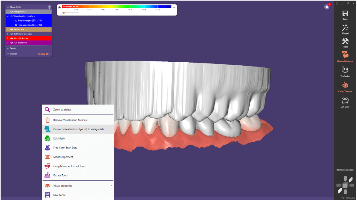 Use of Dynamic Occlusion Data in exocad Medit Help Center