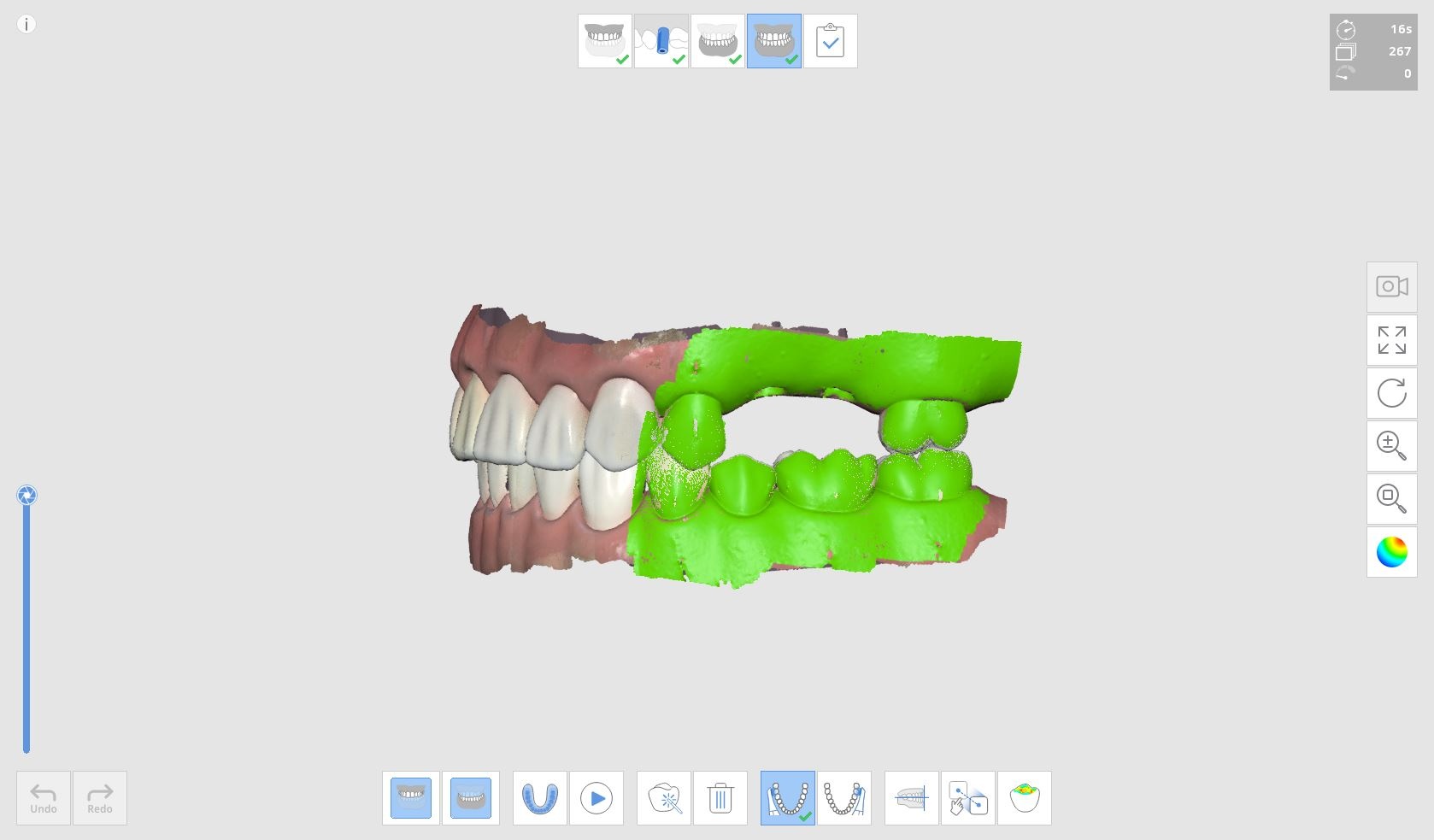 Scanbody Medit Help Center