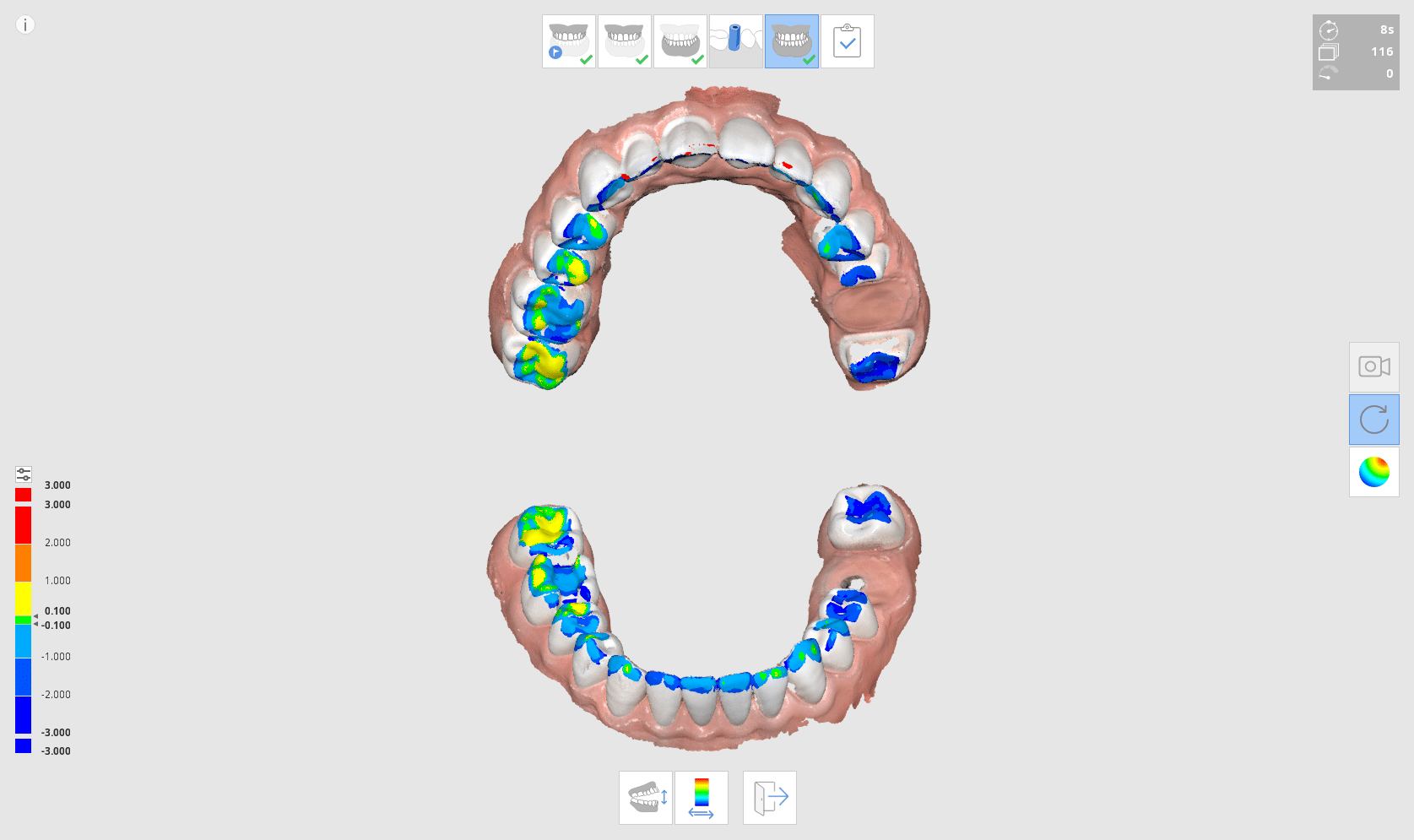 Occlusion analysis Medit Help Center