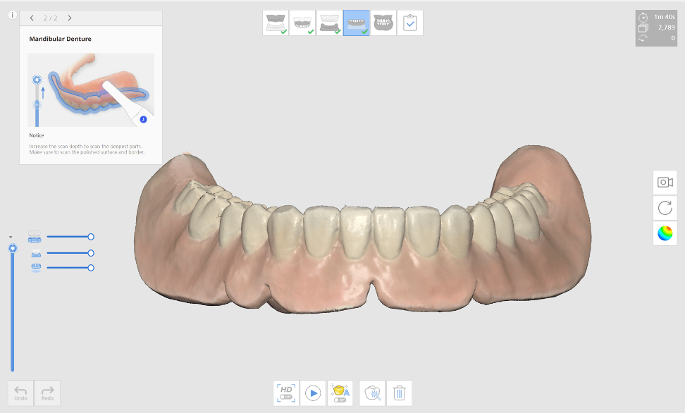 Full denture scan Medit Help Center