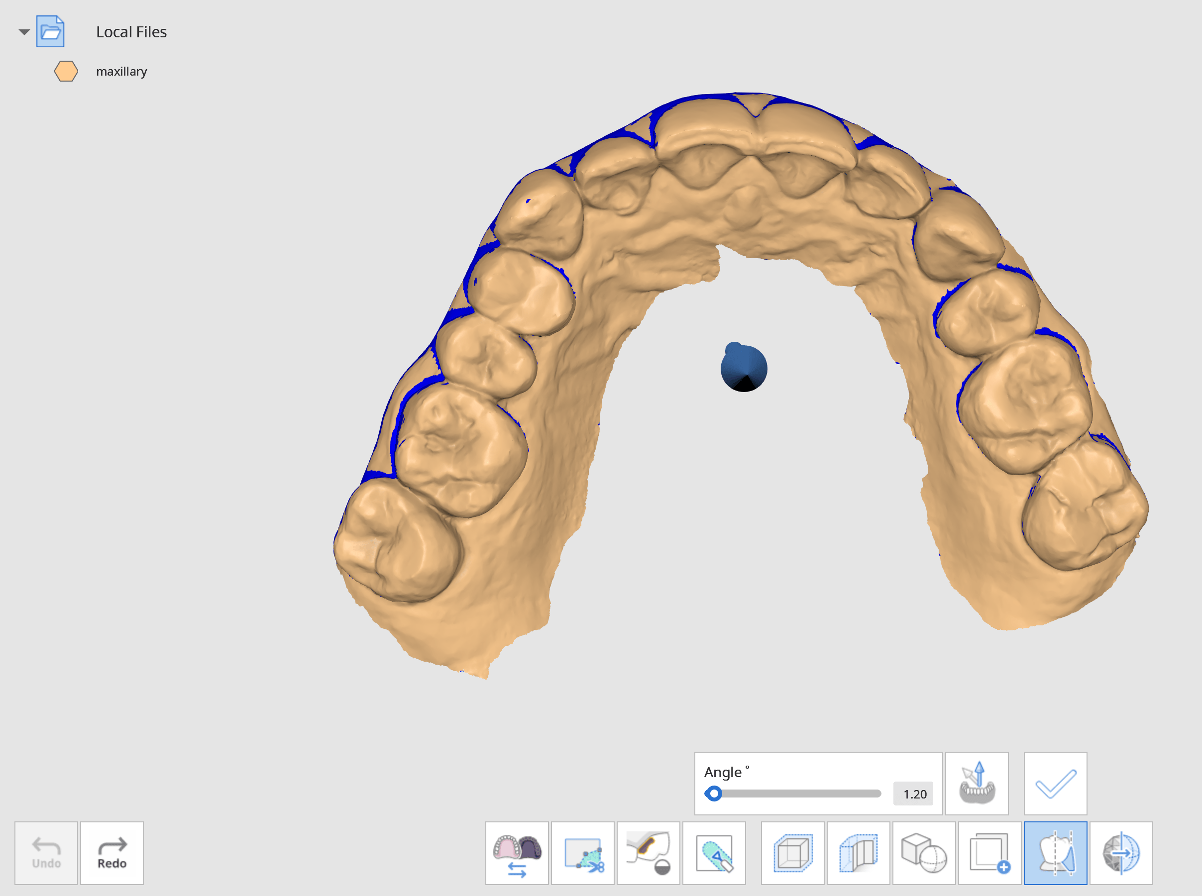 Blockout undercut Medit Help Center