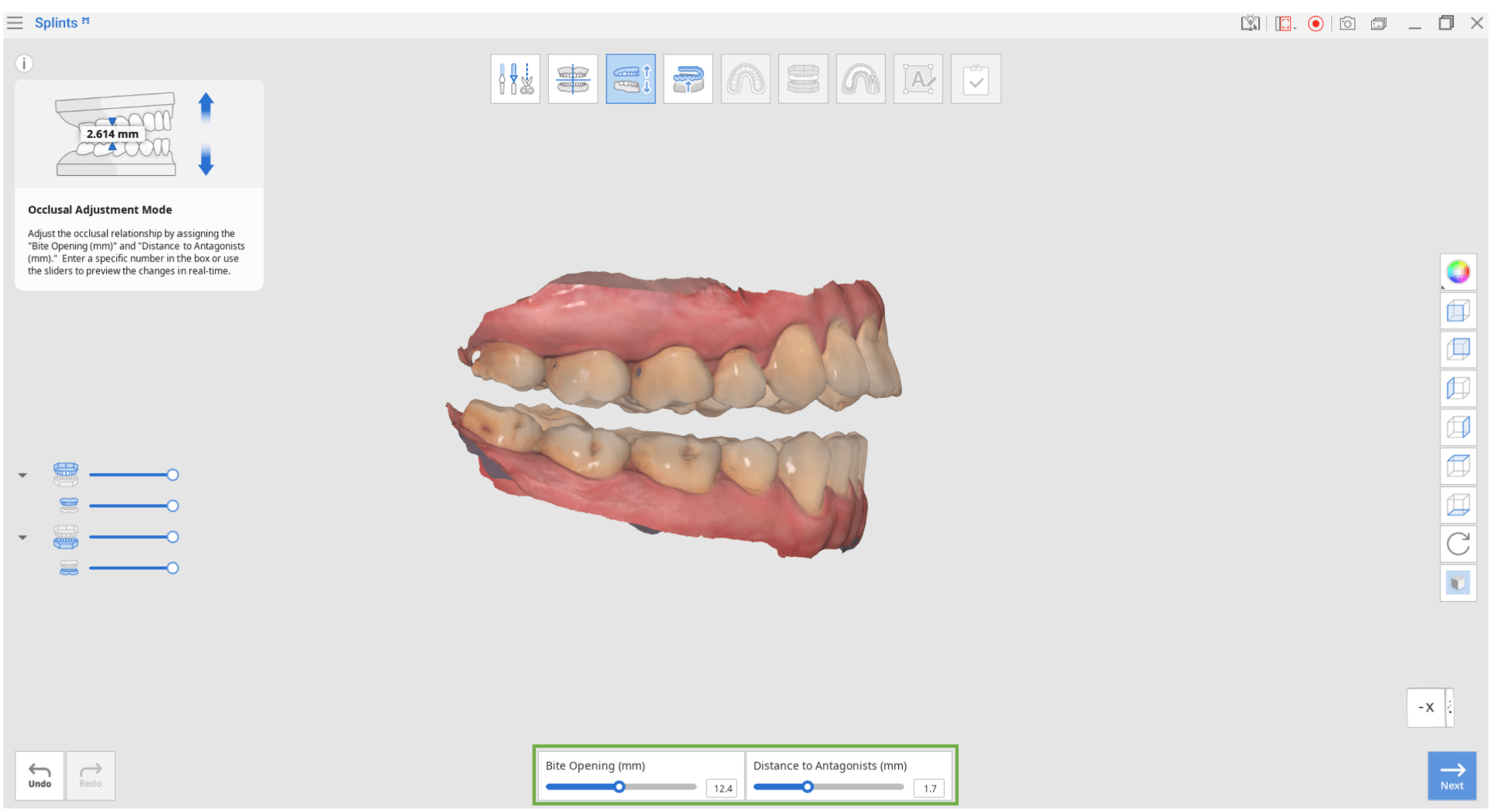 Modo > Ajuste oclusal Centro de Ayuda de Medit