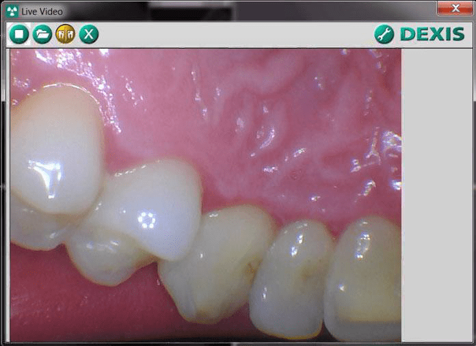 Dexis 9 MouthWatch Help Center