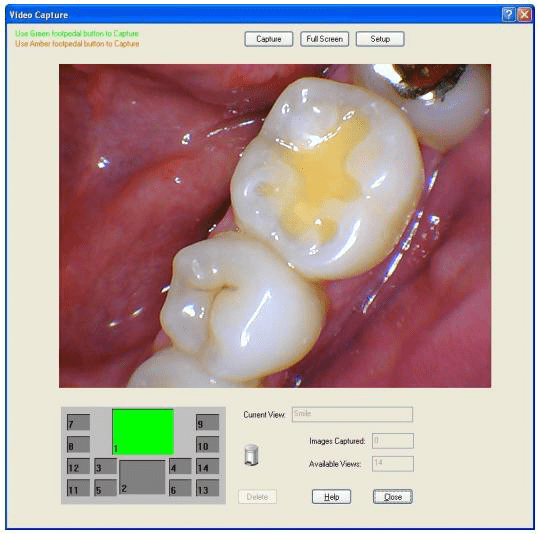 Schick MouthWatch Help Center
