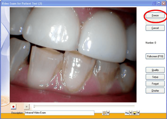 Eaglesoft/Patterson Imaging MouthWatch Help Center