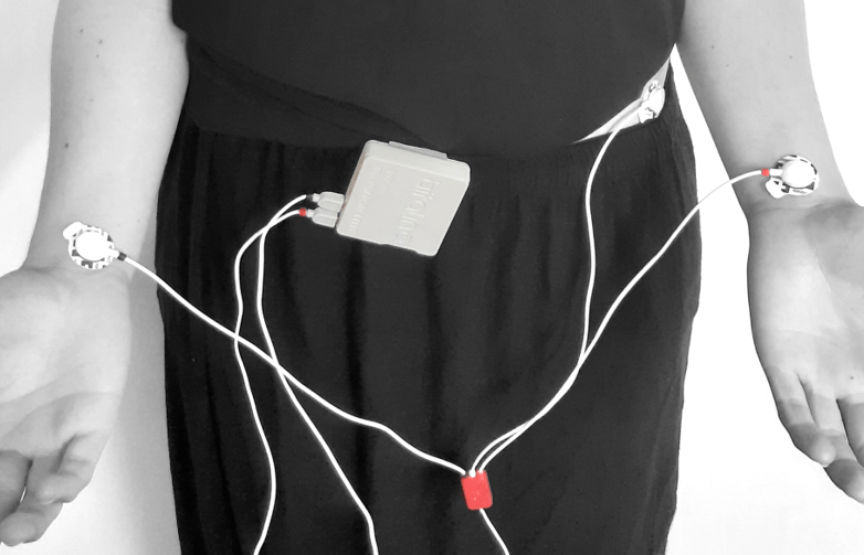 Where should I place my Electrocardiography (ECG) electrodes? Support