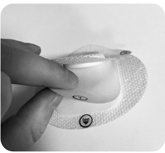 Assembly and positioning of sensor and patch – SENS Innovation ApS