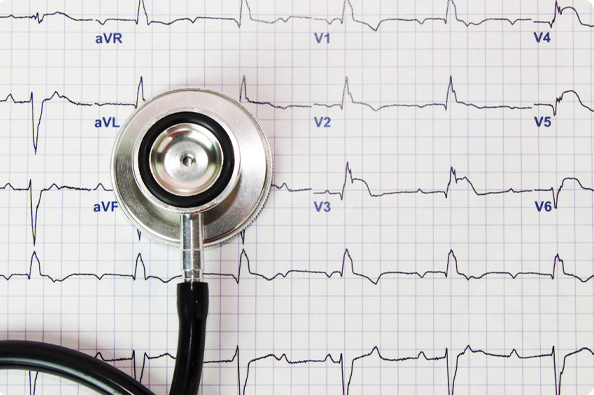Electrocardiogram (ECG or EKG) | SureFire CPR