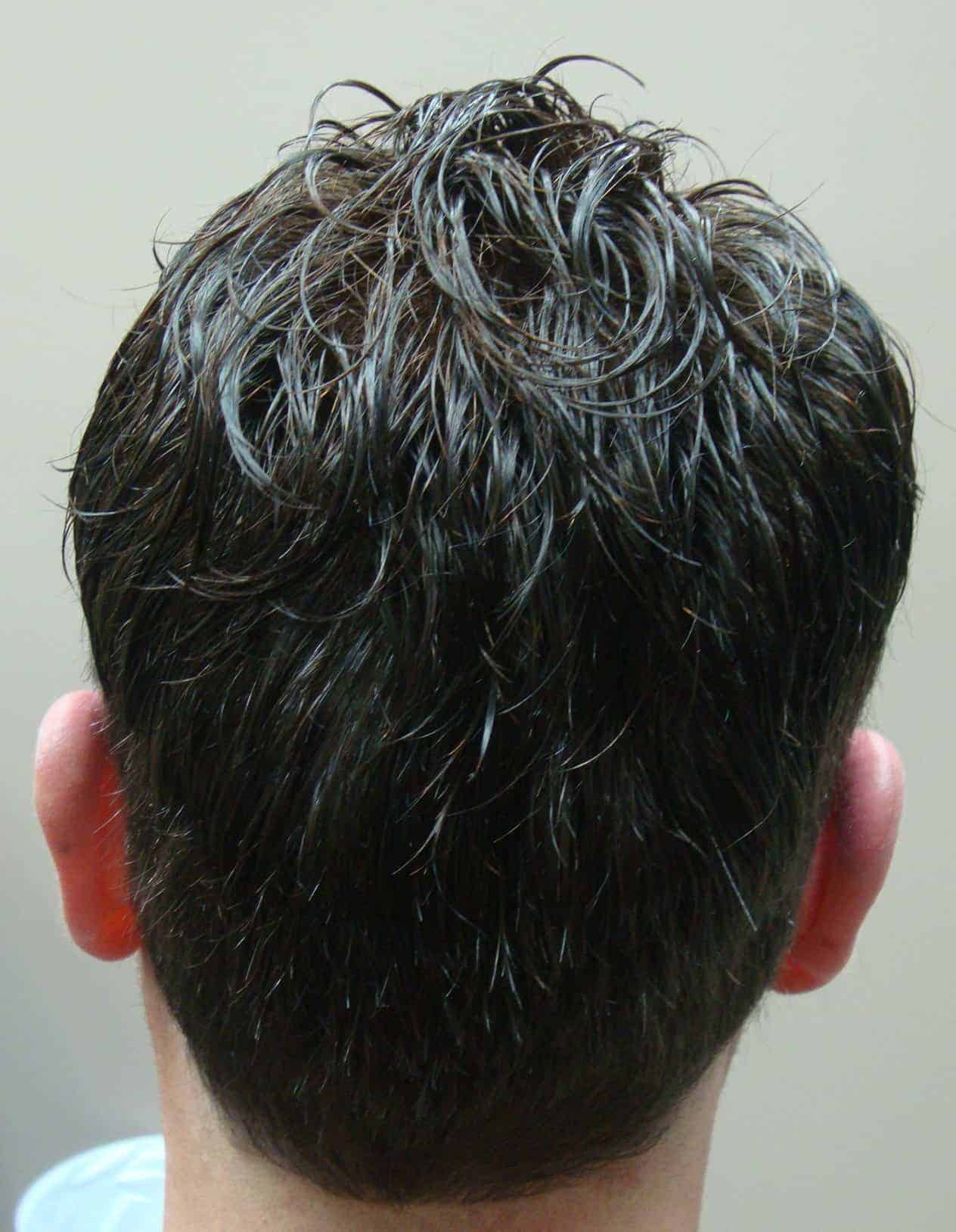 Custom Hair Replacement Systems Sales & Service Centres in Toronto