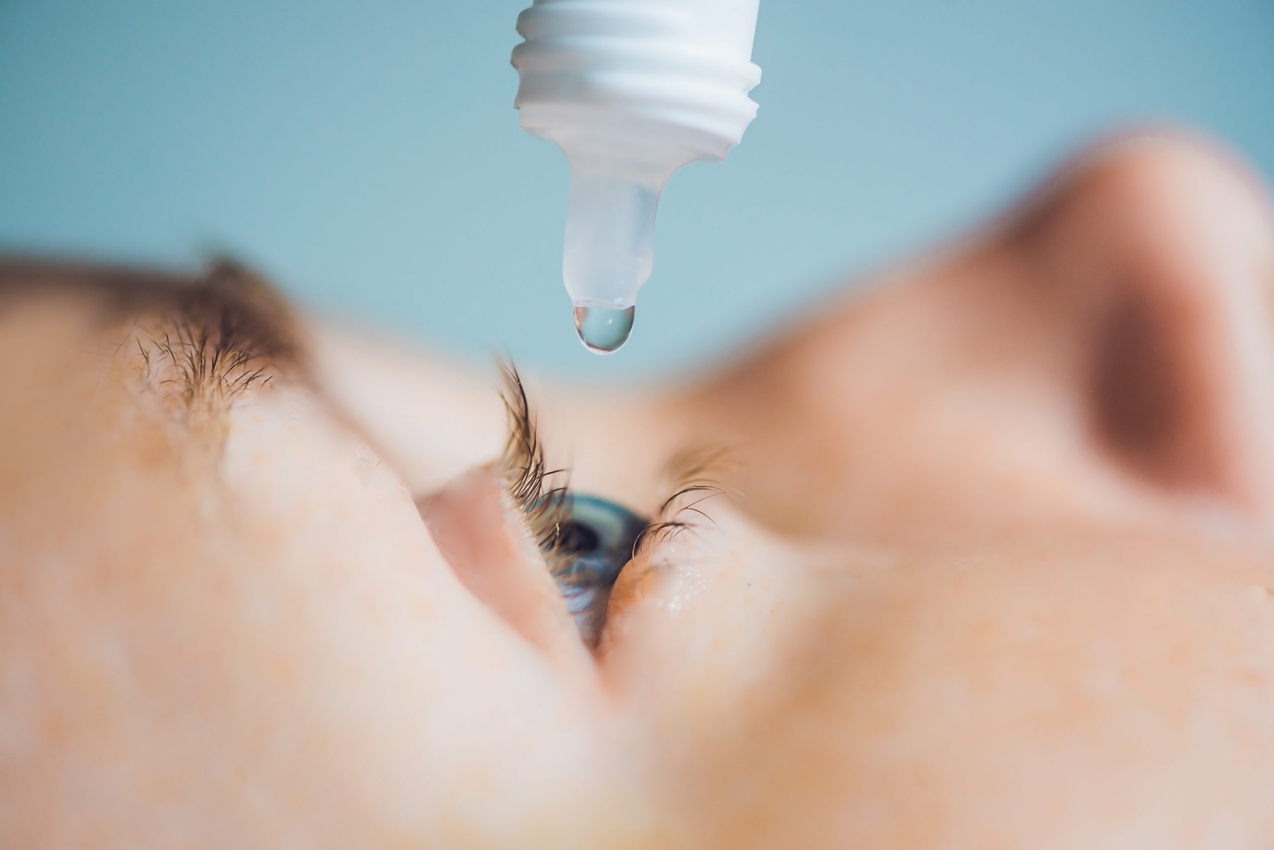 Pink Eye, Allergies & Dry Eyes What’s the Difference? SureVision