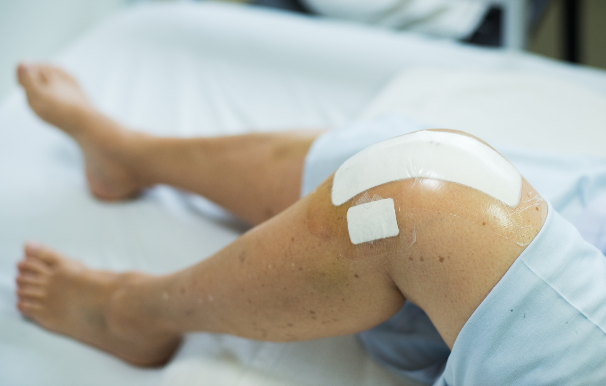 How Does a Knee Surgeon Help With a Personal Injury Case? Surgeons On