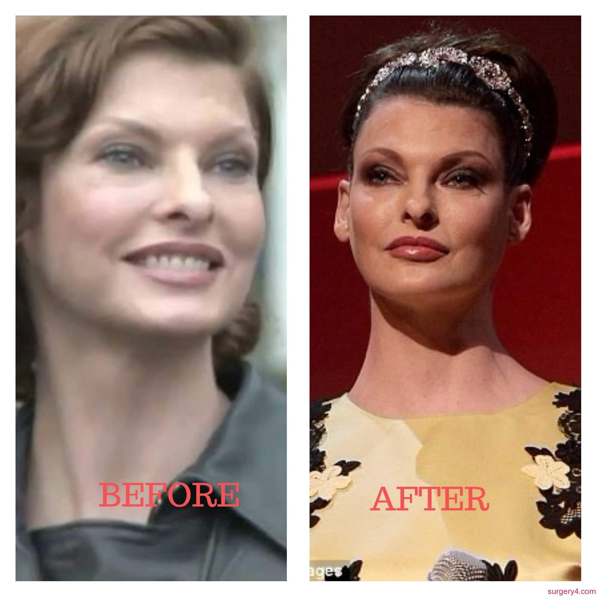 Linda Evangelista Before And After Photos