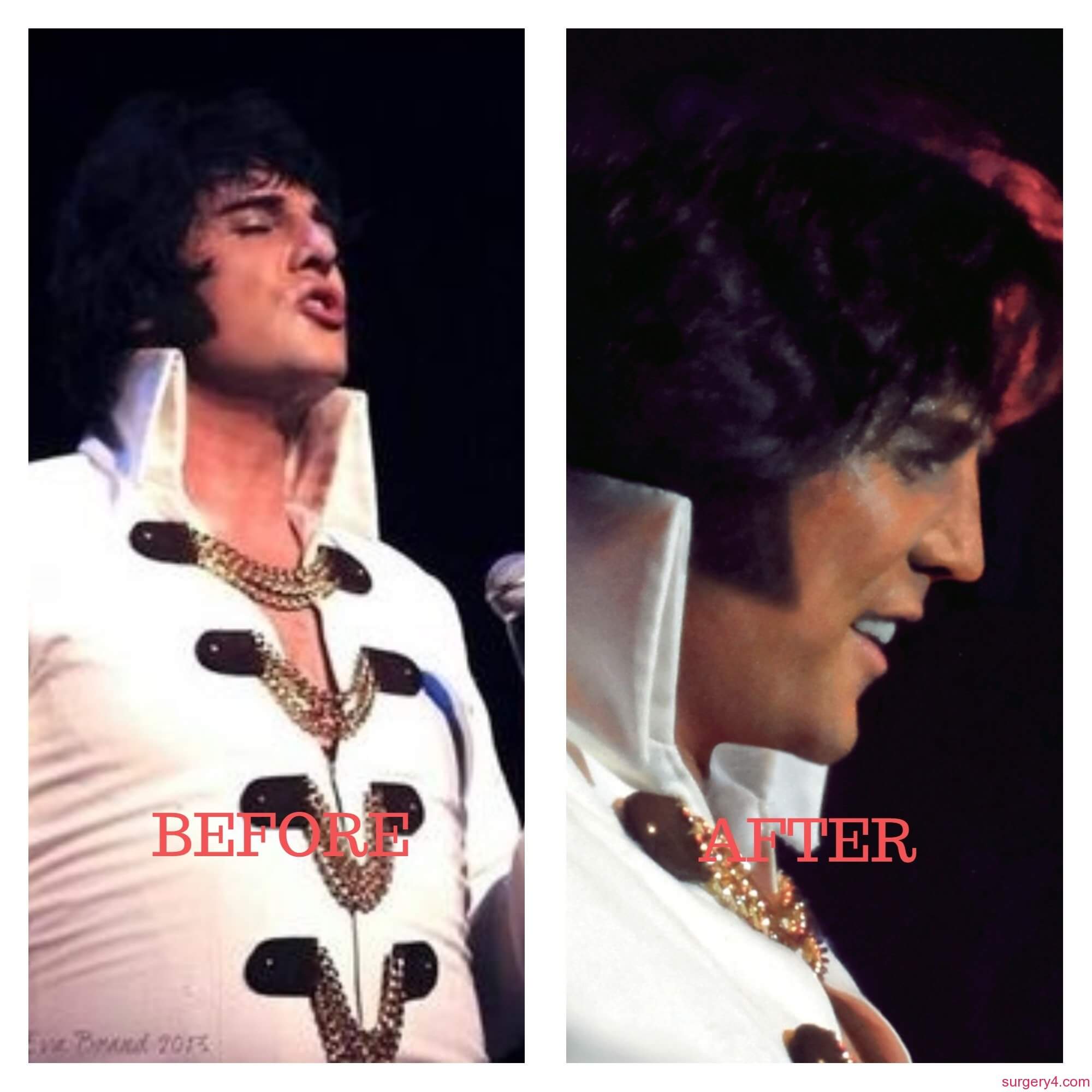 Shawn Klush Plastic Surgery Photos [Before & After] Surgery4