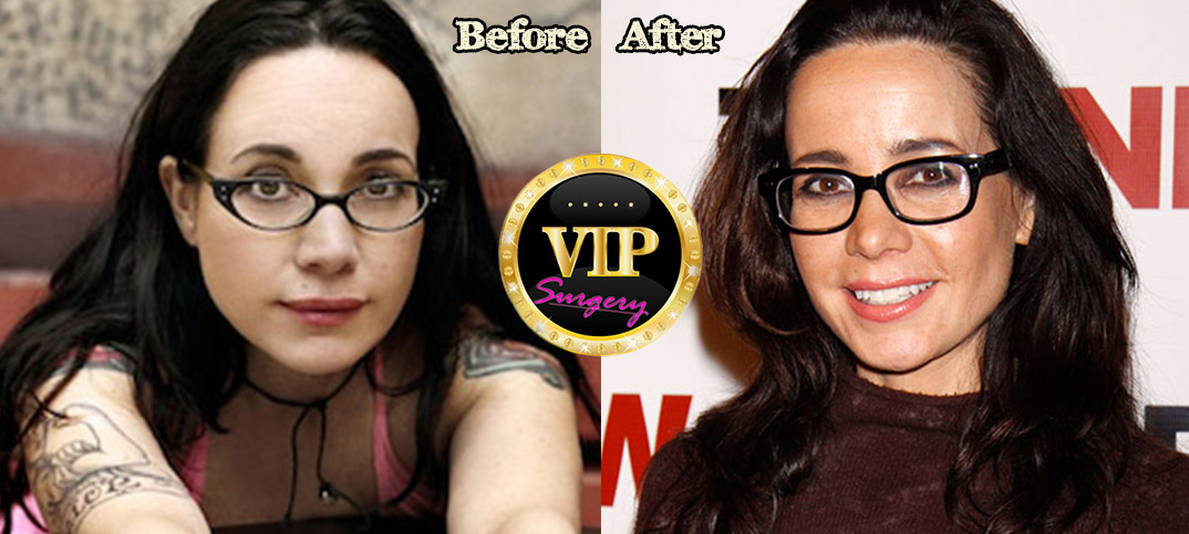 Janeane Garofalo Plastic Surgery Before And After Photos