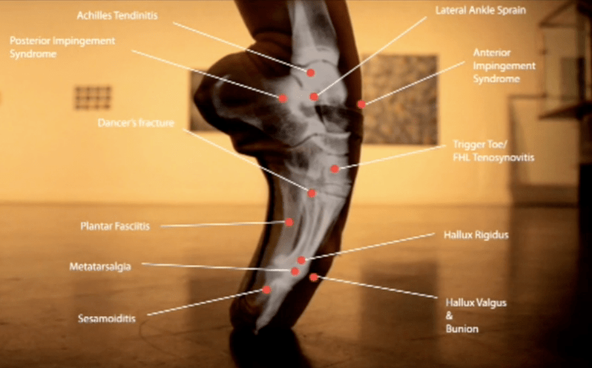 InjuriesFeet Susquehanna Spine & Rehab