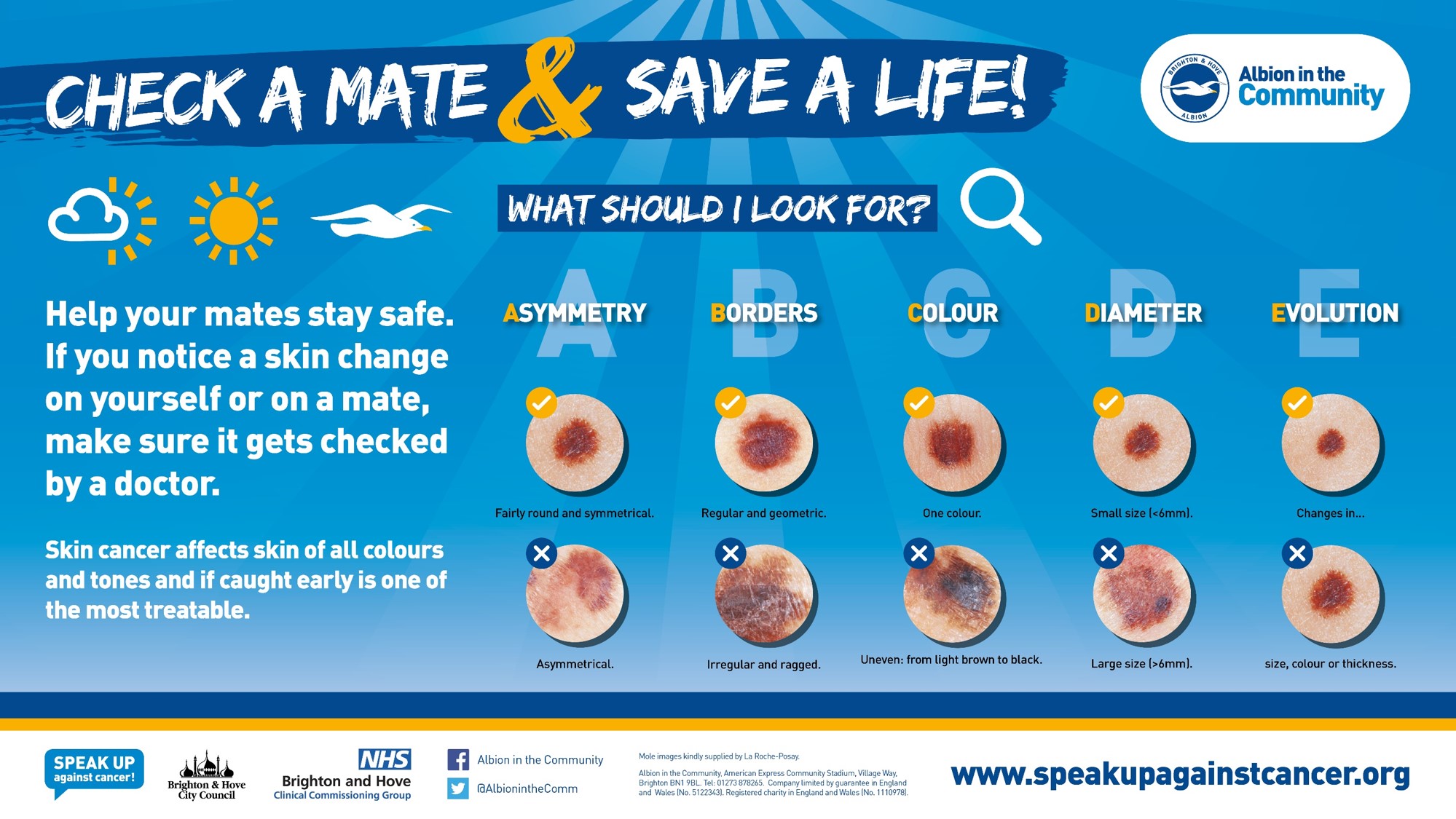 Mole Check "Check a Mate" campaign Sussex Interpreting Services