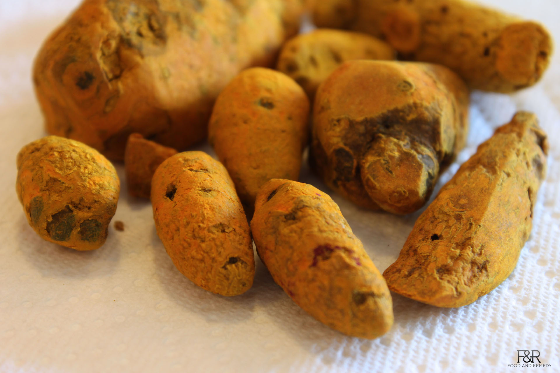 Turmeric Home Remedies Swayampaaka ಸ್ವಯಂ ಪಾಕ