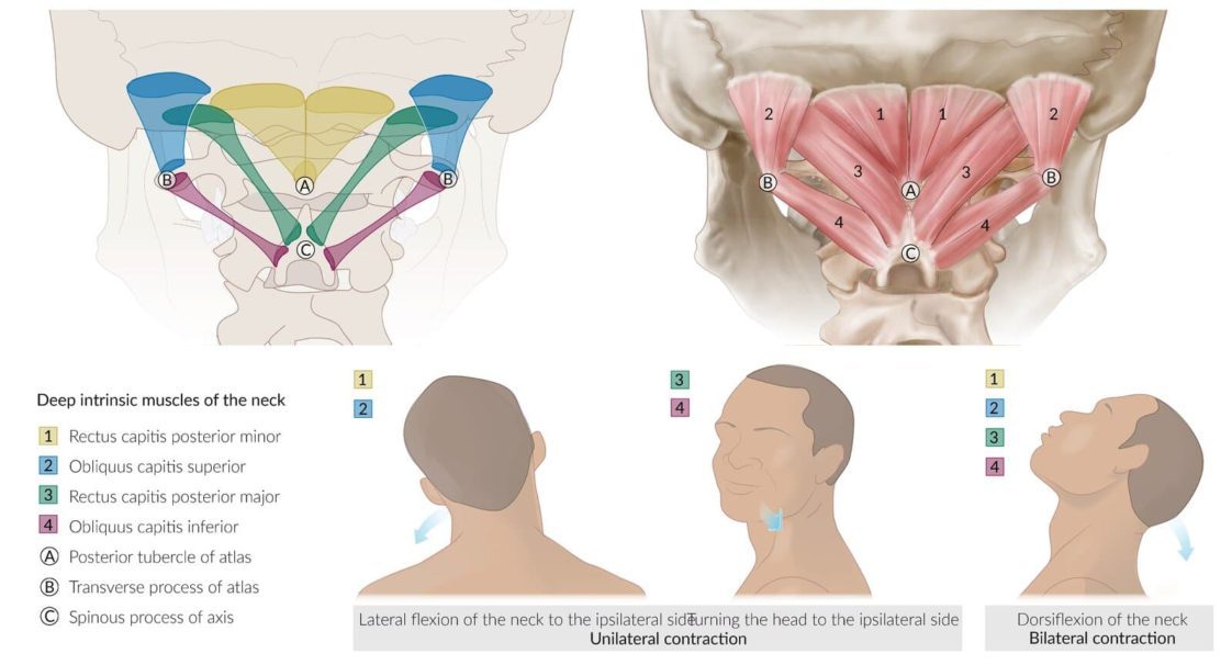 Dealing With Neck Pain & JiuJitsu (BJJ) Sweet Science of Fighting