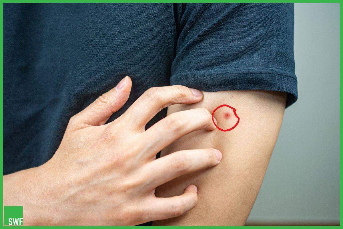 Damages And Diseases Caused By Bed Bugs SWF Egypt Pest Control